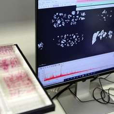 Imaging Mass Spectrometry Unit